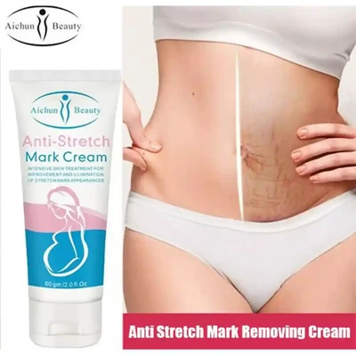 anti stretch mark cream (60gm)